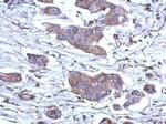 RNaseH1 Antibody in Immunohistochemistry (Paraffin) (IHC (P))