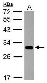 PSMB7 Antibody in Western Blot (WB)