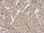 UBE2V2 Antibody in Immunohistochemistry (Paraffin) (IHC (P))