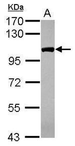 CPSF2 Antibody in Western Blot (WB)