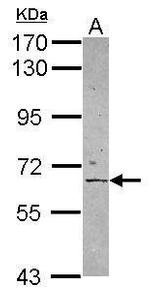 PAT1 Antibody in Western Blot (WB)