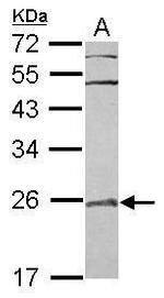 RAB29 Antibody in Western Blot (WB)