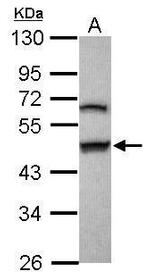 GSDMB Antibody in Western Blot (WB)