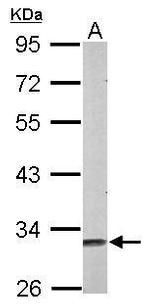 MSI2 Antibody in Western Blot (WB)