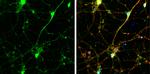 SNAP23 Antibody in Immunocytochemistry (ICC/IF)