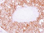 SNAP23 Antibody in Immunohistochemistry (Paraffin) (IHC (P))