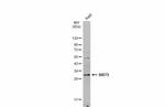 SIRT5 Antibody in Western Blot (WB)