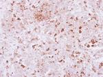 SPRED2 Antibody in Immunohistochemistry (Paraffin) (IHC (P))