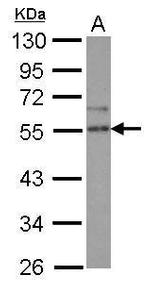 SPRED2 Antibody in Western Blot (WB)