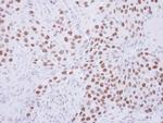 SENP3 Antibody in Immunohistochemistry (Paraffin) (IHC (P))