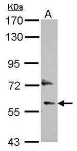 DEPDC7 Antibody in Western Blot (WB)