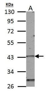 HOXC10 Antibody in Western Blot (WB)