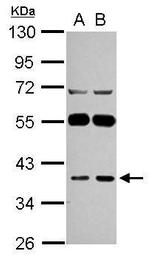 LANCL1 Antibody in Western Blot (WB)