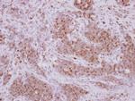 PRELID1 Antibody in Immunohistochemistry (Paraffin) (IHC (P))