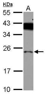 PRELID1 Antibody in Western Blot (WB)