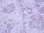 GALNT2 Antibody in Immunohistochemistry (Paraffin) (IHC (P))