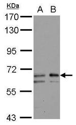 GALNT2 Antibody in Western Blot (WB)