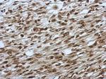 SLU7 Antibody in Immunohistochemistry (Paraffin) (IHC (P))