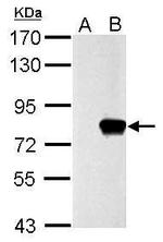 SLU7 Antibody in Western Blot (WB)