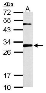 CHMP2B Antibody in Western Blot (WB)