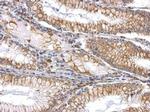 SLIT2 Antibody in Immunohistochemistry (Paraffin) (IHC (P))