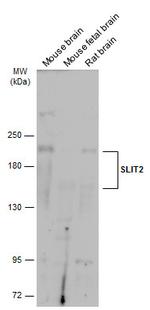 SLIT2 Antibody in Western Blot (WB)