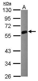 Mig-6 Antibody in Western Blot (WB)