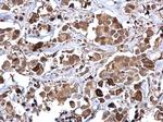 RAD51 Antibody in Immunohistochemistry (Paraffin) (IHC (P))