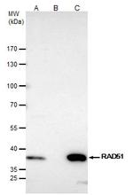 RAD51 Antibody in Immunoprecipitation (IP)