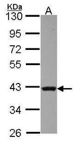 RAD51 Antibody in Western Blot (WB)