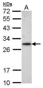 RNF212 Antibody in Western Blot (WB)