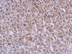 RAB39B Antibody in Immunohistochemistry (Paraffin) (IHC (P))