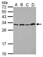 PSME1 Antibody in Western Blot (WB)