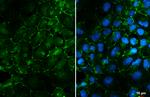 CAR Antibody in Immunocytochemistry (ICC/IF)