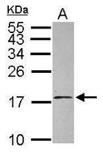 eIF1AY Antibody in Western Blot (WB)