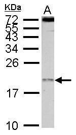 eIF1AY Antibody in Western Blot (WB)