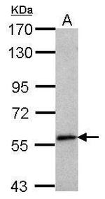 SEMA6C Antibody in Western Blot (WB)