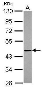 PIGO Antibody in Western Blot (WB)