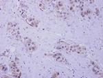 HIP55 Antibody in Immunohistochemistry (Paraffin) (IHC (P))