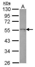 HIP55 Antibody in Western Blot (WB)