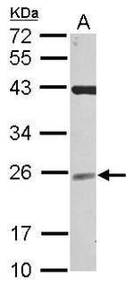 NCE2 Antibody in Western Blot (WB)