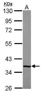 CFHR1 Antibody in Western Blot (WB)