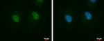 JTV-1 Antibody in Immunocytochemistry (ICC/IF)