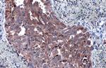 P4HA1 Antibody in Immunohistochemistry (Paraffin) (IHC (P))