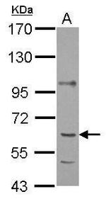 P4HA1 Antibody in Western Blot (WB)