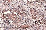 TSG101 Antibody in Immunohistochemistry (Paraffin) (IHC (P))