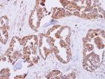 MRPL11 Antibody in Immunohistochemistry (Paraffin) (IHC (P))