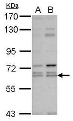 KLHL12 Antibody in Western Blot (WB)