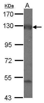 ADCY2 Antibody in Western Blot (WB)