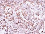 PTPN14 Antibody in Immunohistochemistry (Paraffin) (IHC (P))